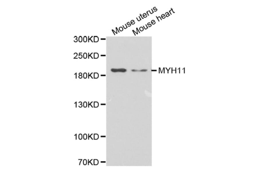Western Blot - Anti-MYH11 Antibody (A1498) - Antibodies.com