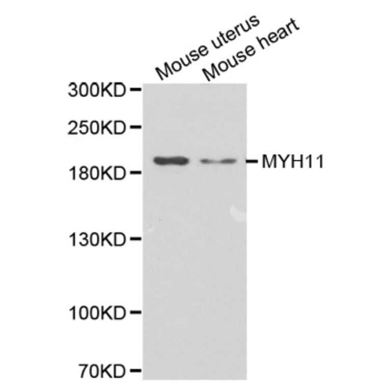 Western Blot - Anti-MYH11 Antibody (A1498) - Antibodies.com