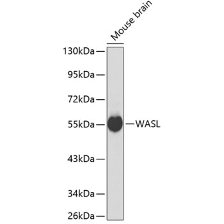 Western Blot - Anti-WASL Antibody (A0153) - Antibodies.com