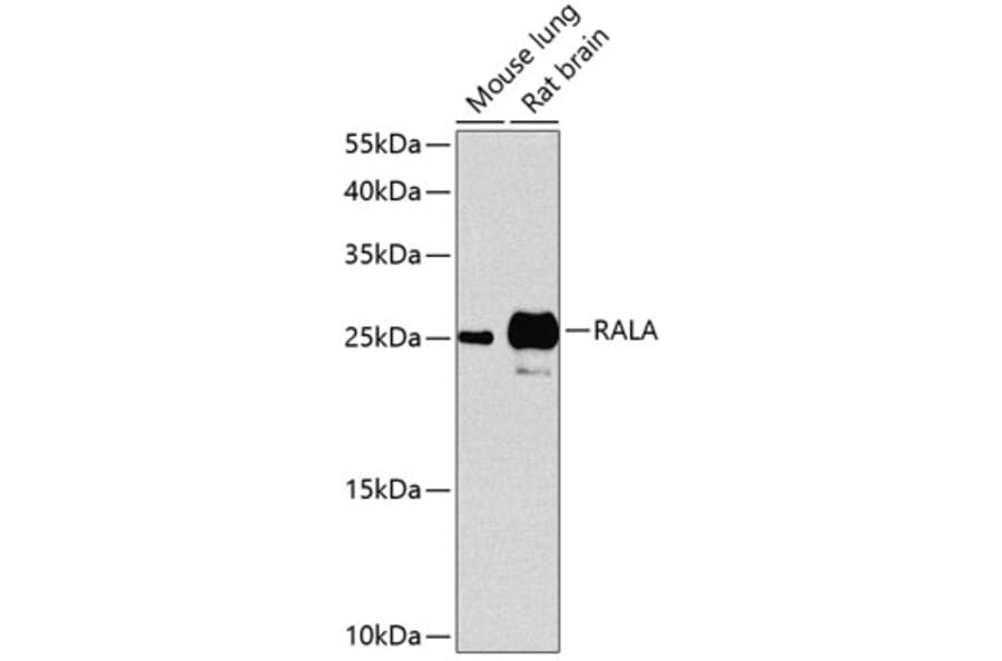 Western Blot - Anti-RALA Antibody (A17135) - Antibodies.com