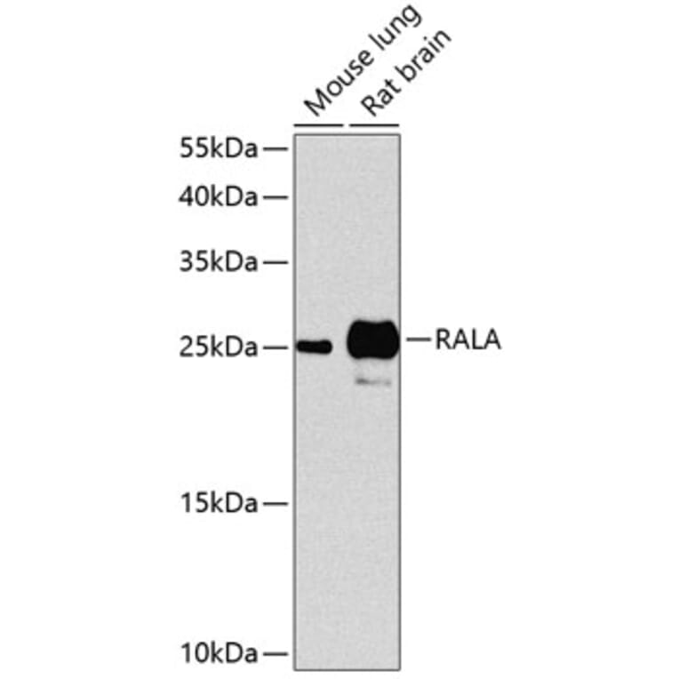 Western Blot - Anti-RALA Antibody (A17135) - Antibodies.com