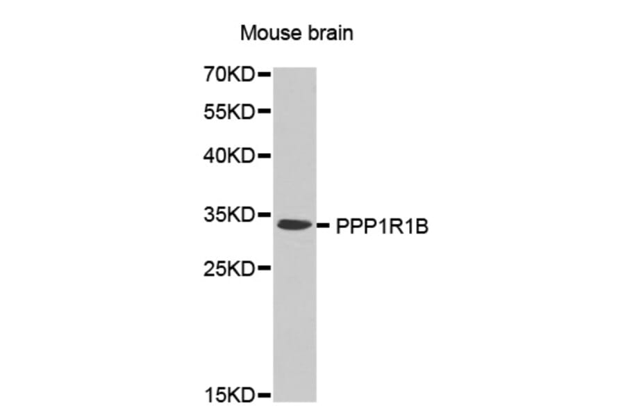 Western Blot - Anti-PPP1R1B Antibody (A0625) - Antibodies.com