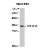 Western Blot - Anti-PPP1R1B Antibody (A0625) - Antibodies.com
