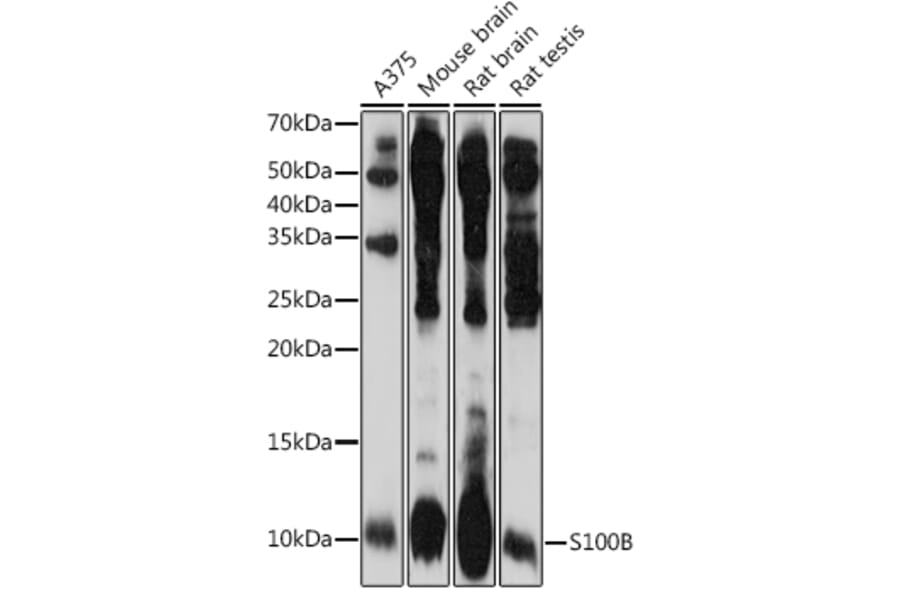 Western Blot - Anti-S100 beta Antibody (A17137) - Antibodies.com