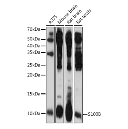 Western Blot - Anti-S100 beta Antibody (A17137) - Antibodies.com