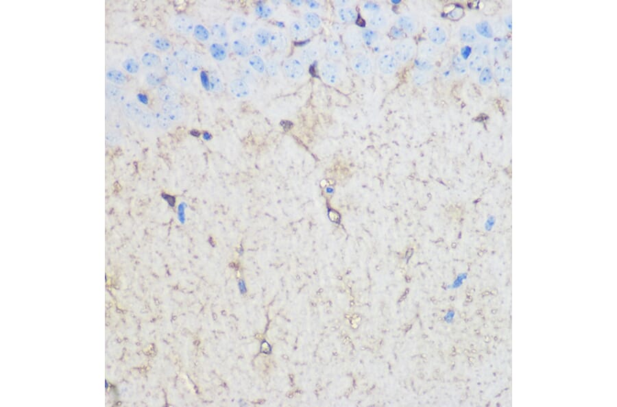 Immunohistochemistry - Anti-S100 beta Antibody (A17137) - Antibodies.com