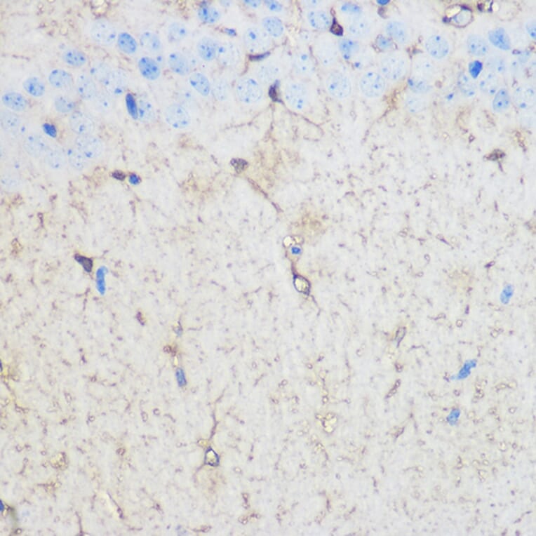 Immunohistochemistry - Anti-S100 beta Antibody (A17137) - Antibodies.com