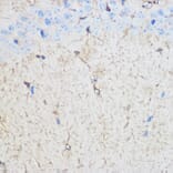 Immunohistochemistry - Anti-S100 beta Antibody (A17137) - Antibodies.com