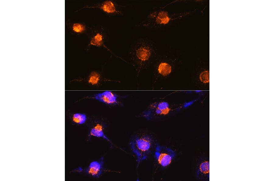 Immunofluorescence - Anti-S100 beta Antibody (A17137) - Antibodies.com
