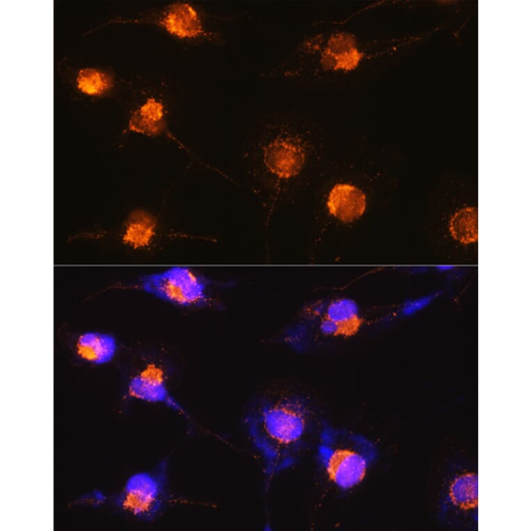 Immunofluorescence - Anti-S100 beta Antibody (A17137) - Antibodies.com