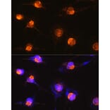 Immunofluorescence - Anti-S100 beta Antibody (A17137) - Antibodies.com