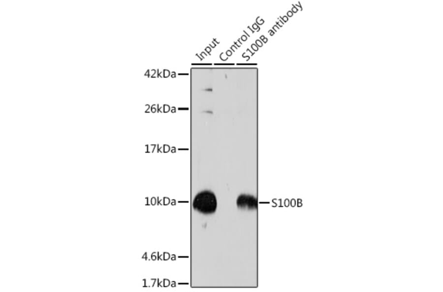 Western Blot - Anti-S100 beta Antibody (A17137) - Antibodies.com