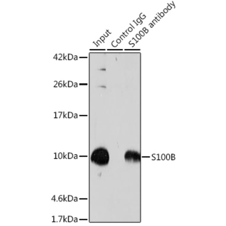 Western Blot - Anti-S100 beta Antibody (A17137) - Antibodies.com