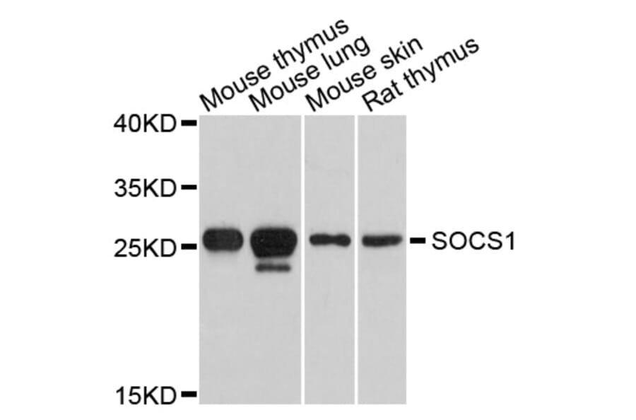 Western Blot - Anti-SOCS1 Antibody (A0820) - Antibodies.com
