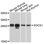 Western Blot - Anti-SOCS1 Antibody (A0820) - Antibodies.com