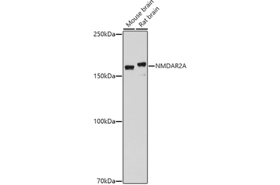 Western Blot - Anti-NMDAR2A Antibody (A17139) - Antibodies.com