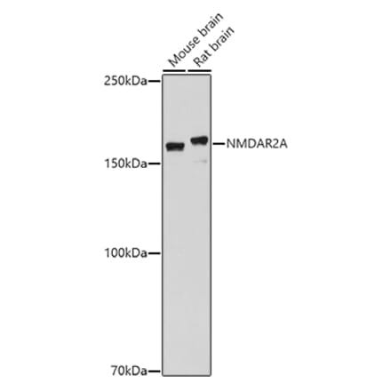 Western Blot - Anti-NMDAR2A Antibody (A17139) - Antibodies.com
