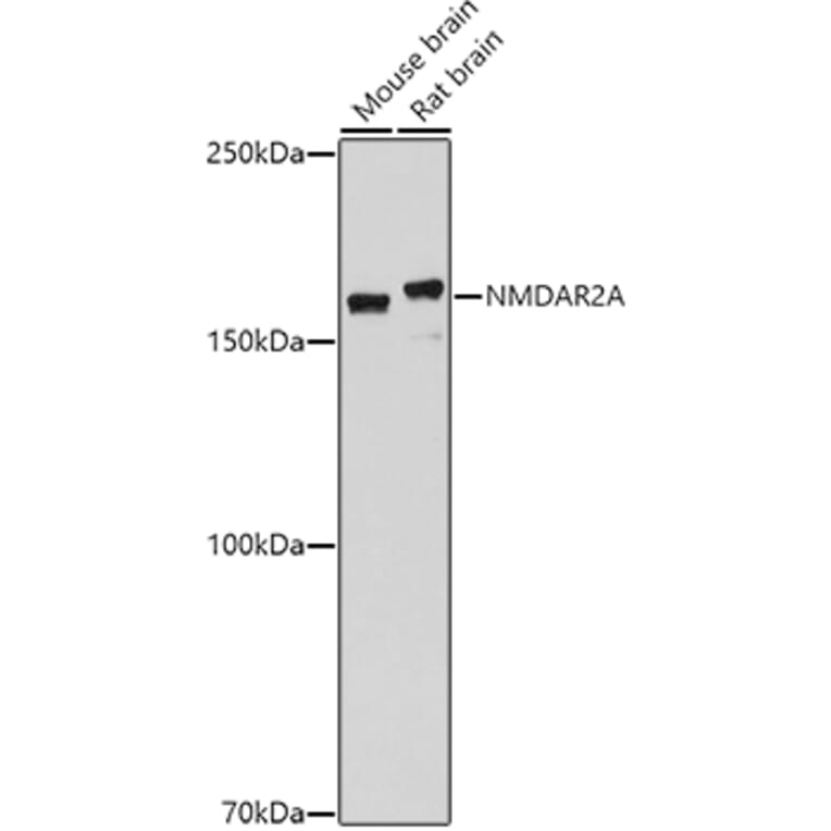 Western Blot - Anti-NMDAR2A Antibody (A17139) - Antibodies.com