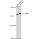 Western Blot - Anti-NMDAR2A Antibody (A17139) - Antibodies.com