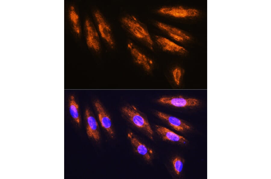 Immunofluorescence - Anti-NMDAR2A Antibody (A17139) - Antibodies.com