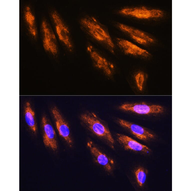 Immunofluorescence - Anti-NMDAR2A Antibody (A17139) - Antibodies.com