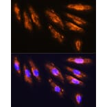 Immunofluorescence - Anti-NMDAR2A Antibody (A17139) - Antibodies.com