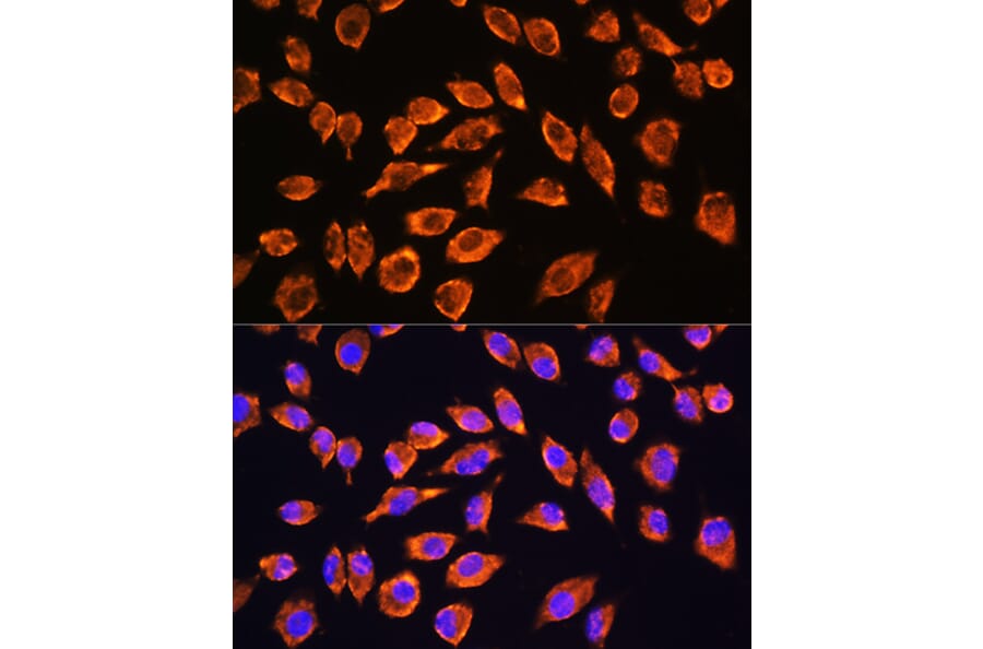 Immunofluorescence - Anti-NMDAR2A Antibody (A17139) - Antibodies.com