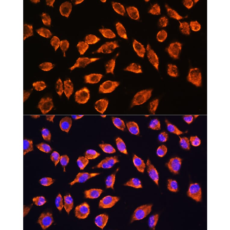 Immunofluorescence - Anti-NMDAR2A Antibody (A17139) - Antibodies.com