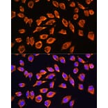 Immunofluorescence - Anti-NMDAR2A Antibody (A17139) - Antibodies.com