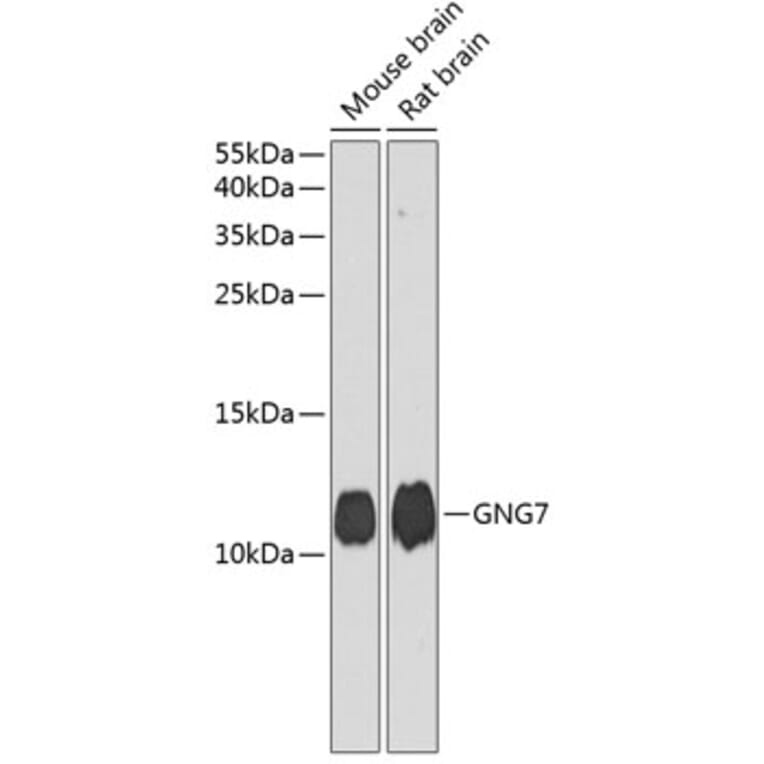 Western Blot - Anti-GNG7 Antibody (A17140) - Antibodies.com
