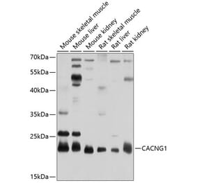 Western Blot - Anti-CACNG1 Antibody (A17141) - Antibodies.com