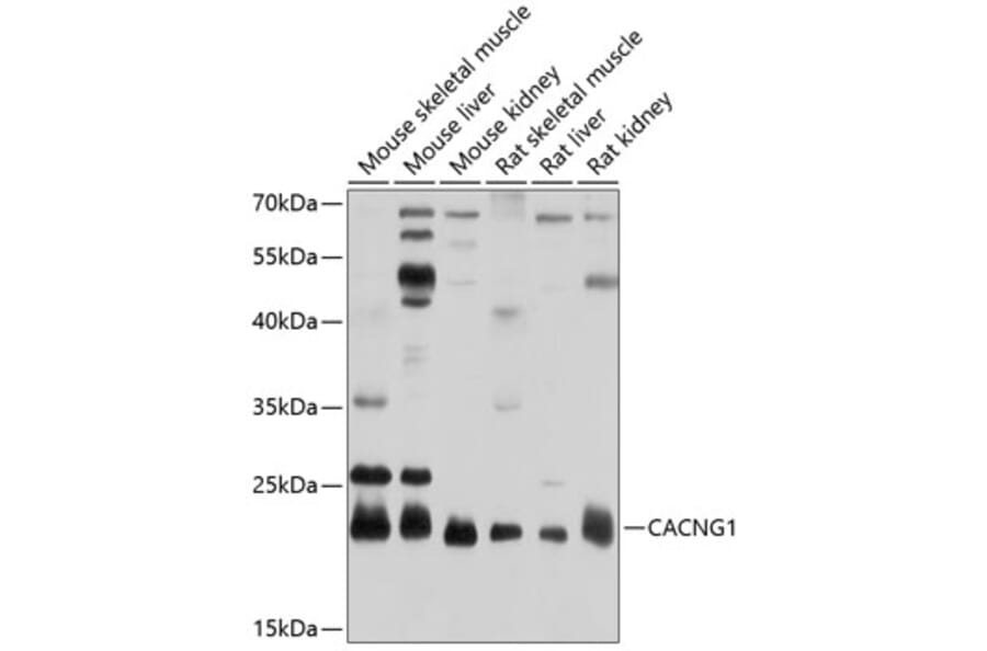 Western Blot - Anti-CACNG1 Antibody (A17141) - Antibodies.com