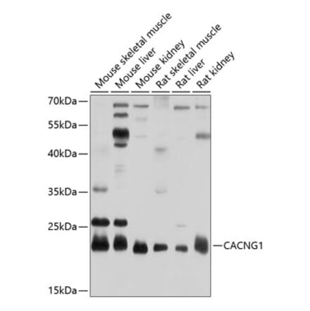 Western Blot - Anti-CACNG1 Antibody (A17141) - Antibodies.com