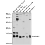 Western Blot - Anti-CACNG1 Antibody (A17141) - Antibodies.com