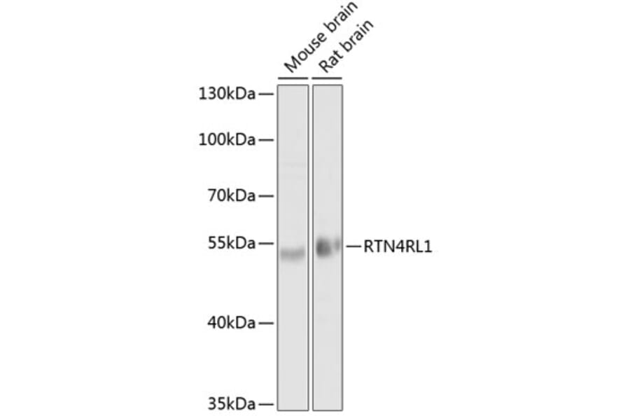 Western Blot - Anti-NgR3 Antibody (A17142) - Antibodies.com