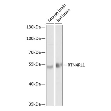 Western Blot - Anti-NgR3 Antibody (A17142) - Antibodies.com