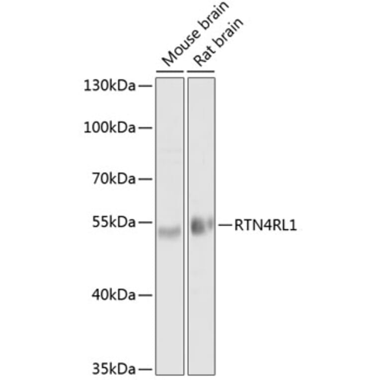Western Blot - Anti-NgR3 Antibody (A17142) - Antibodies.com
