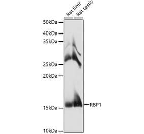 Western Blot - Anti-RBP1 Antibody (A17143) - Antibodies.com