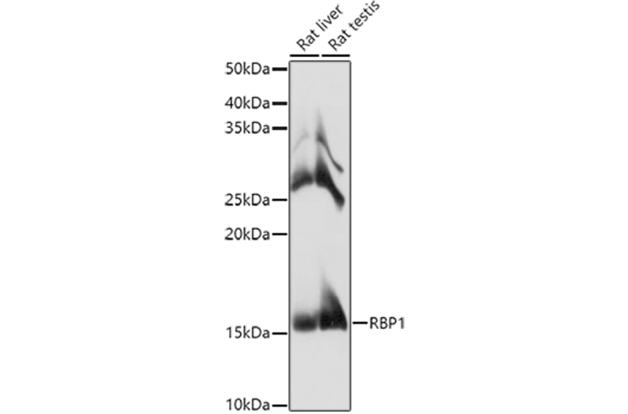 Western Blot - Anti-RBP1 Antibody (A17143) - Antibodies.com