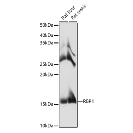 Western Blot - Anti-RBP1 Antibody (A17143) - Antibodies.com