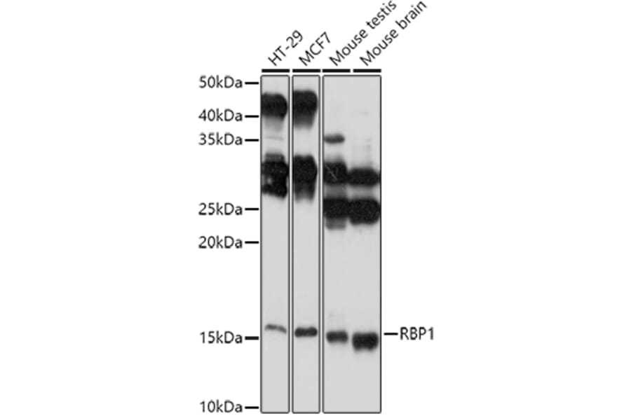 Western Blot - Anti-RBP1 Antibody (A17143) - Antibodies.com