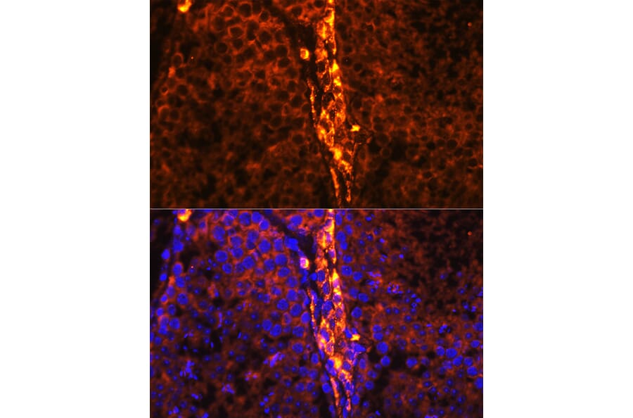 Immunofluorescence - Anti-RBP1 Antibody (A17143) - Antibodies.com