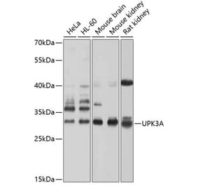 Western Blot - Anti-Uroplakin III Antibody (A17144) - Antibodies.com