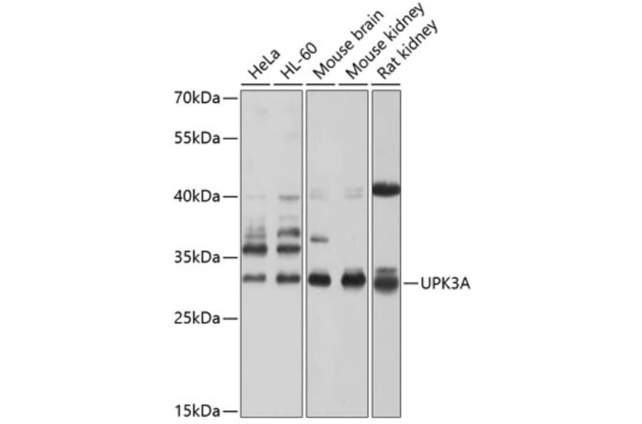 Western Blot - Anti-Uroplakin III Antibody (A17144) - Antibodies.com