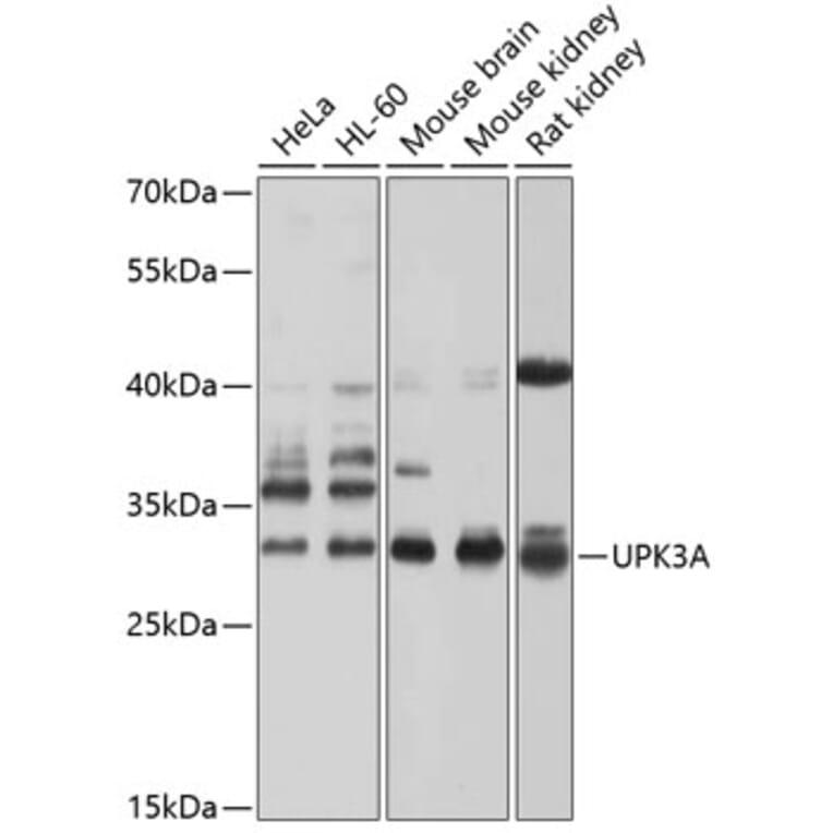 Western Blot - Anti-Uroplakin III Antibody (A17144) - Antibodies.com