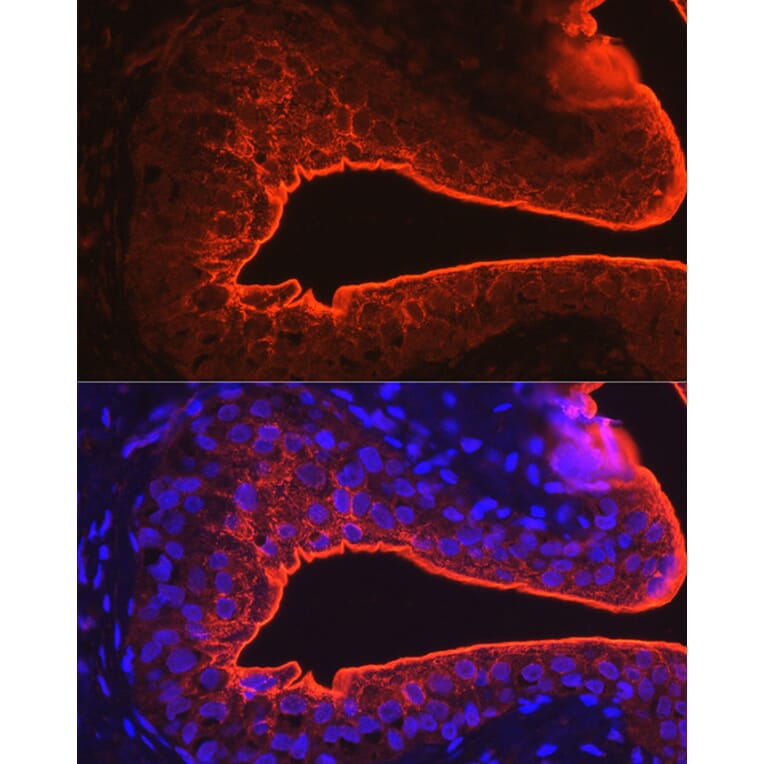 Immunofluorescence - Anti-Uroplakin III Antibody (A17144) - Antibodies.com