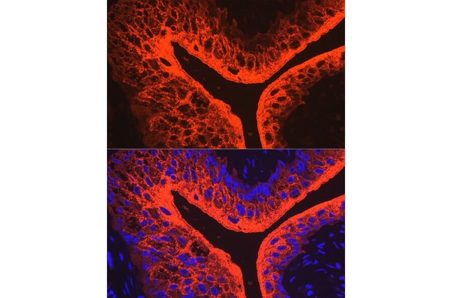 Immunofluorescence - Anti-Uroplakin III Antibody (A17144) - Antibodies.com