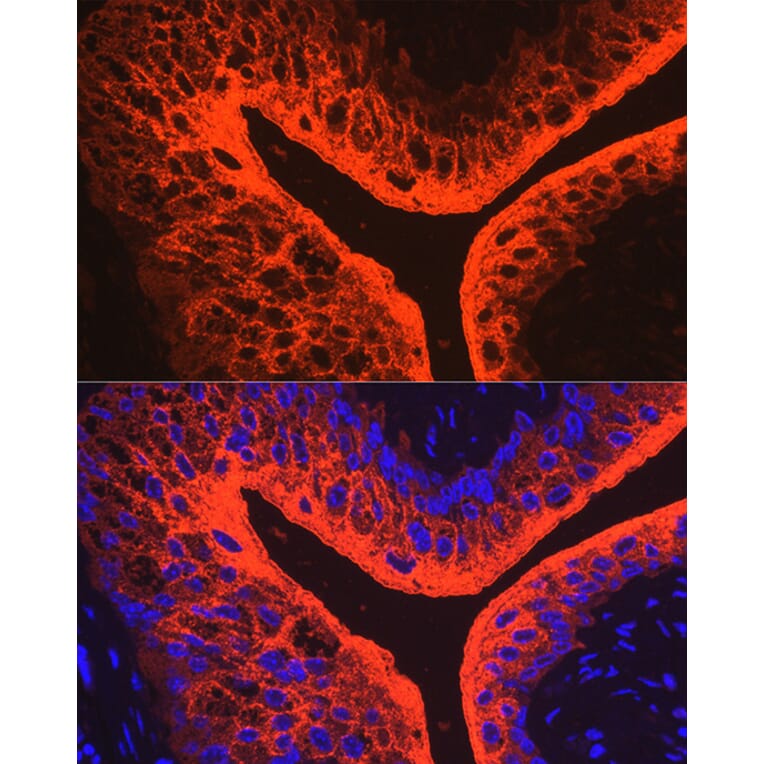 Immunofluorescence - Anti-Uroplakin III Antibody (A17144) - Antibodies.com