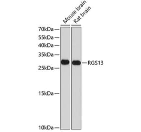 Western Blot - Anti-RGS13 Antibody (A17145) - Antibodies.com