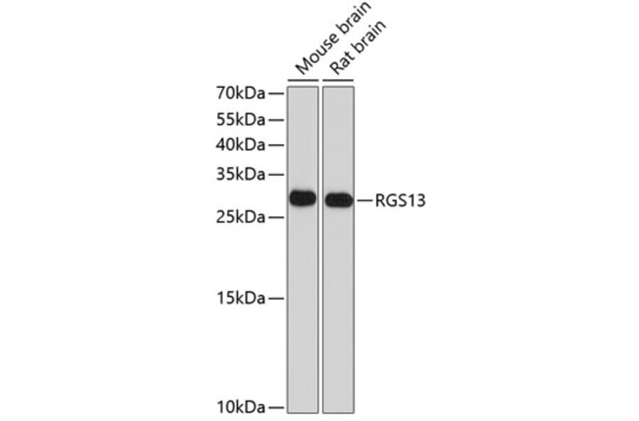 Western Blot - Anti-RGS13 Antibody (A17145) - Antibodies.com